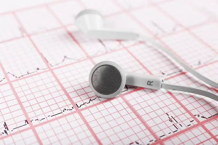 Loop Recorder Implantation