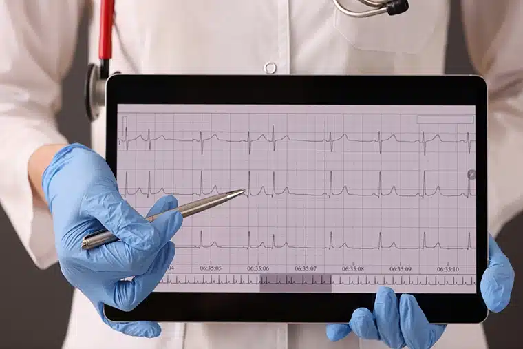 Echocardiogram
